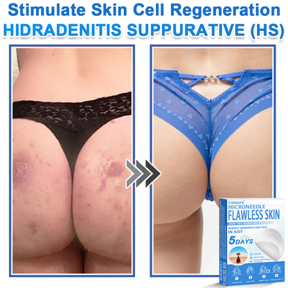 👨‍⚕️ Celsiora® 2-in-1 Microneedle & Hydrocolloid Patch | Raised Moles,Acne,  Flat Warts & Skin Tags Remover | Improves Wrinkles, Scars & Blemishes | Invisible Pimple Patches for Face & Body