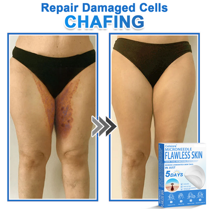 👨‍⚕️ Celsiora® 2-in-1 Microneedle & Hydrocolloid Patch | Raised Moles,Acne,  Flat Warts & Skin Tags Remover | Improves Wrinkles, Scars & Blemishes | Invisible Pimple Patches for Face & Body