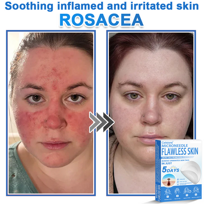 👨‍⚕️ Celsiora® 2-in-1 Microneedle & Hydrocolloid Patch | Raised Moles,Acne,  Flat Warts & Skin Tags Remover | Improves Wrinkles, Scars & Blemishes | Invisible Pimple Patches for Face & Body