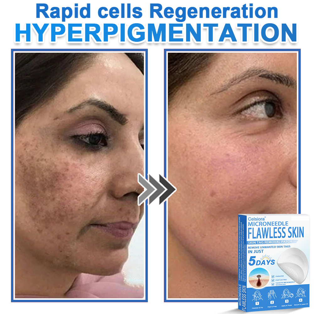 👨‍⚕️ Celsiora® 2-in-1 Microneedle & Hydrocolloid Patch | Raised Moles,Acne,  Flat Warts & Skin Tags Remover | Improves Wrinkles, Scars & Blemishes | Invisible Pimple Patches for Face & Body