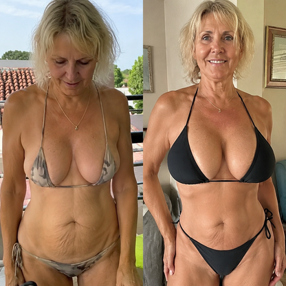 LUMIVO™ Targeted Breast Enhancement Advanced Nano Microneedle Patch